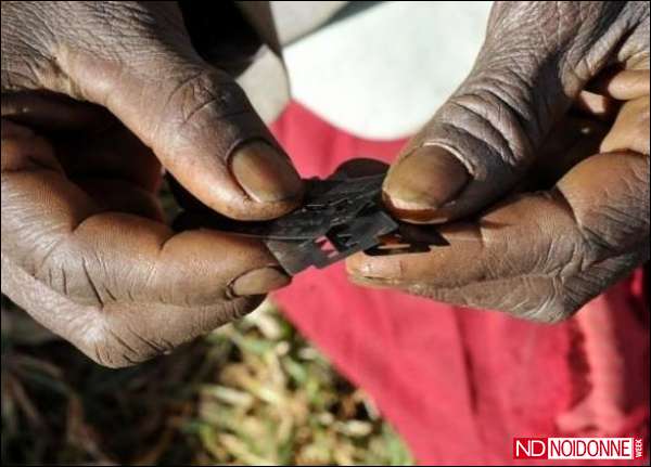 Foto: Le mutilazioni genitali femminili. Ancora una battaglia da vincere in Egitto